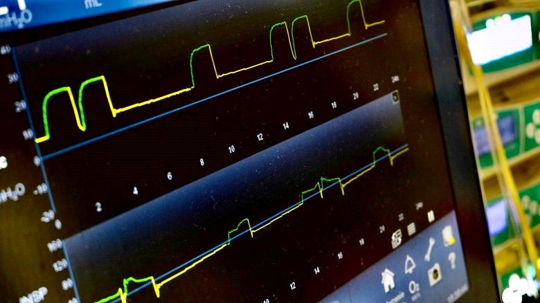 Pielęgniarki – nowy podział uprawnień w zakresie EKG i monitorowania z podziałem na grupy.