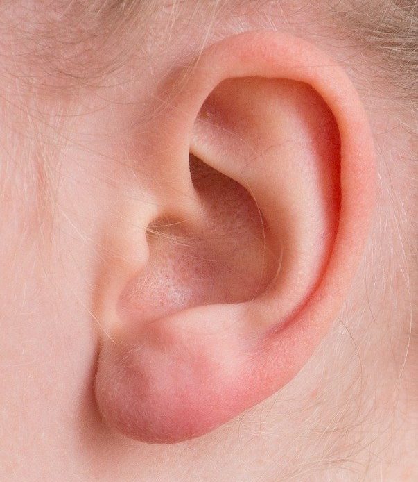 Jakie są przyczyny zapalenia ucha?