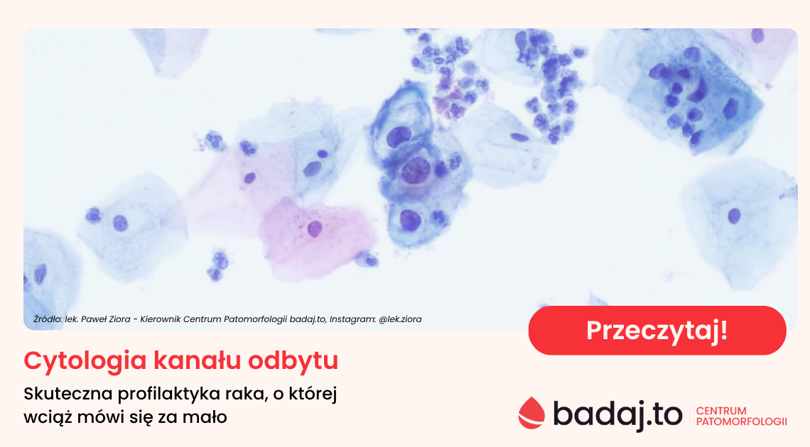 Cytologia kanału odbytu – skuteczna profilaktyka raka, o której wciąż mówi się za mało.